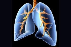 Can Mesothelioma Ever Be Cured? : A Comprehensive Guide