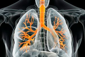 Understanding Different Types of Mesothelioma : Comprehensive Guide