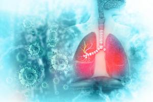 How Does Mesothelioma Start? : Early Signs of Mesothelioma