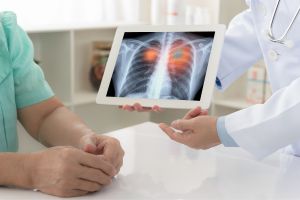 Mesothelioma Attorney Assistance : Legal Proceedings