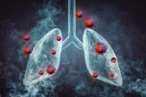 Stage 1 Mesothelioma Survival Rate in 2024 : Detailed Survival Rate Insights