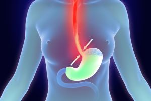 Symptoms of Mesothelioma in the Stomach