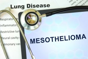 Understanding Pleural Mesothelioma Stages : Comprehensive Guide