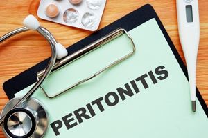 What are the Symptoms of Peritoneal Mesothelioma : A Comprehensive Guide