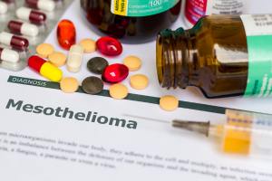 What is Papillary Mesothelioma? : An In-Depth Guide