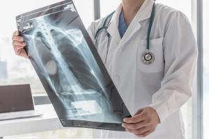 What is the Average Settlement for a Mesothelioma Case? : A Complete Guide