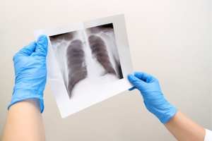 What part of the body is affected by mesothelioma