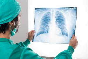 What Type of Lung Cancer is Caused by Asbestos? : A Comprehensive Guide