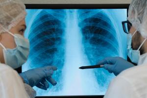 Which Body Parts are Affected by Mesothelioma in 2024? : A Complete Guide