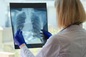 Why are men more susceptible to mesothelioma? : Understanding the Risks and Implications